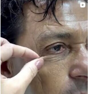 Registro educativo de cuidado da região dos olhos