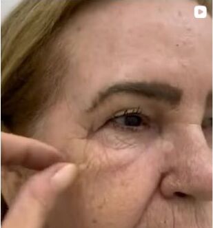Registro educativo de avaliação da região dos olhos